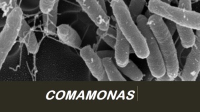 Image of organism in genus Comamonas kerstersii