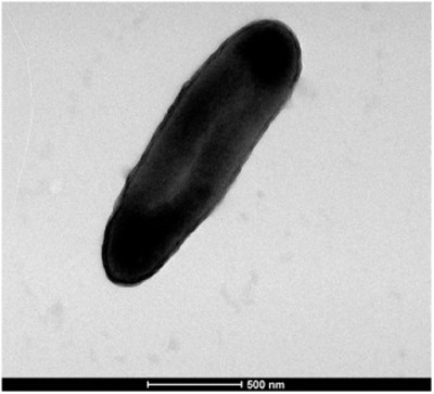 Image of organism in genus Dakarella massiliensis