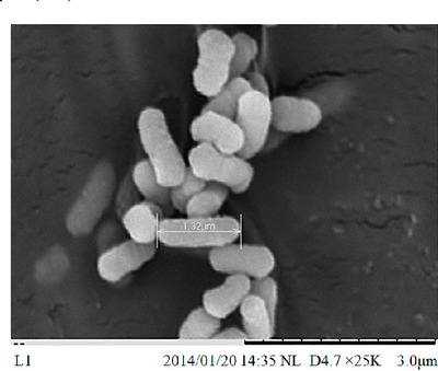 Image of organism in genus Enterobacter asburiae