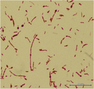 msp_1457 - Species | Microbiome Atlas