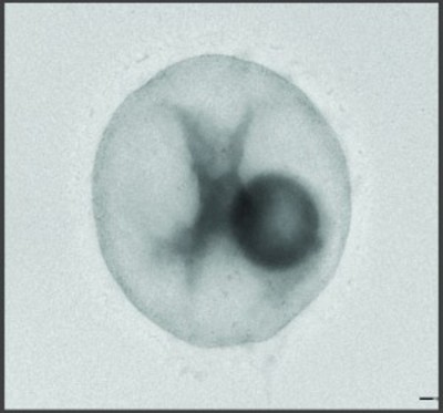 Image of organism in genus Candidatus Methanomassiliicoccus intestinalis