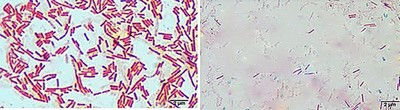 Image of organism in genus Oxalobacter formigenes 1