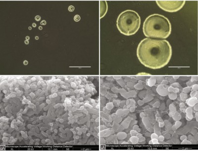 Image of organism in genus Parasutterella excrementihominis