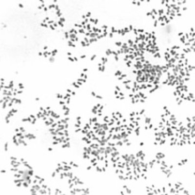 Image of organism in genus Pyramidobacter piscolens